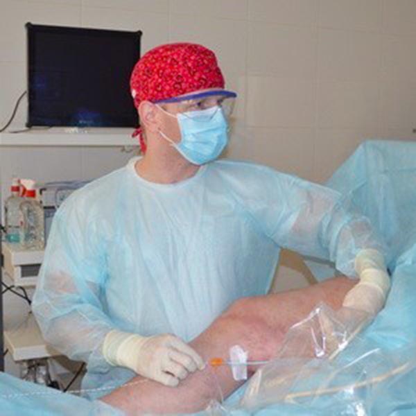 Современное лечение варикозных вен