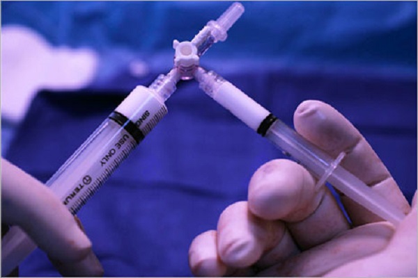 Современное лечение варикозных вен