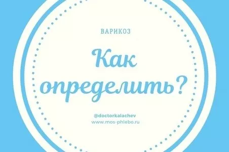Как определить, есть ли у вас варикоз?