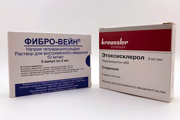Пенная склеротерапия в Москве